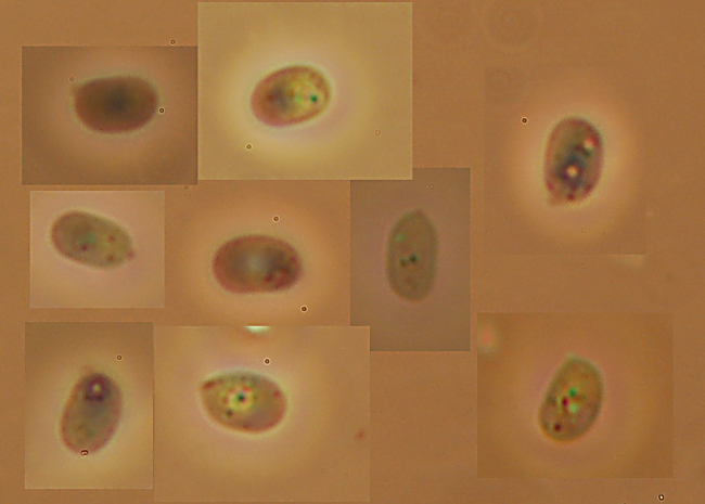 Crosta da determinare - foto 0939 (Schizopora sp.)